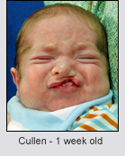 Cullen before surgery