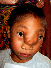 Oswaldo before surgery